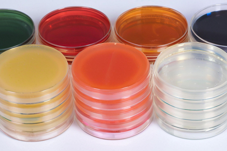 Babio SDA Culture Medium Supports Global Demand for Fungal Detection