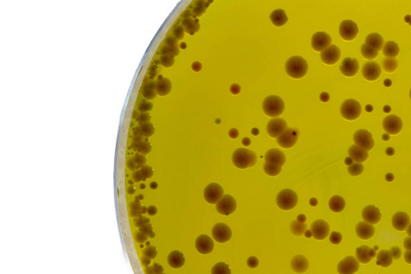 BABIO Launches High-Quality Baird-Parker Agar Base for Reliable Staphylococci Testing