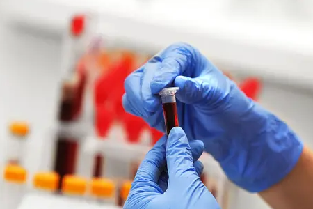 Rapid Malaria Detection: BABIO’s Dual Antigen Test Kit Empowers Global Health