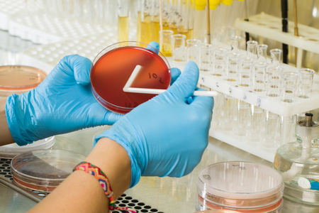 MS Medium: A Reliable Foundation for Modern Plant Tissue Culture