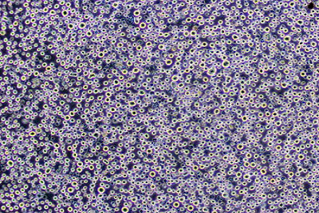 Orange Serum Agar: Supporting Beverage Microbiology and Quality Control